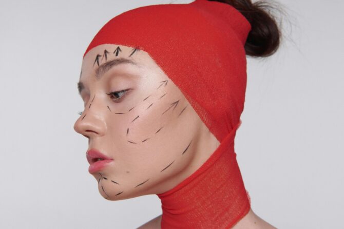 Facelift: 12 things to know